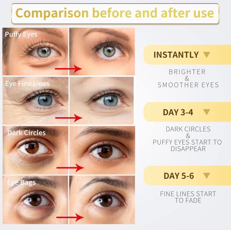 24K Gold Under Eye Patches - 60 Pack for Puffy Eyes, Dark Circles, Bags & Wrinkles with Collagen & Hyaluronic Acid - Image 2
