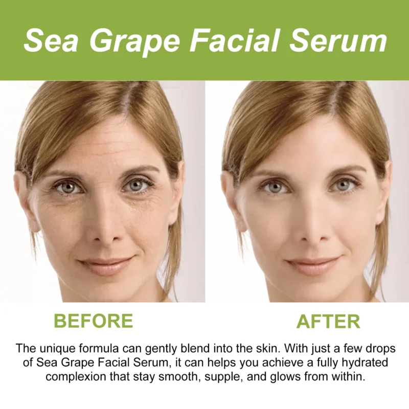 EELHOE Sea Grape Polypeptide Facial Essence Fade Fine Line Anti-wrinkle Firming Skin Lifting Moisturizing Booster Face Serum - Image 3