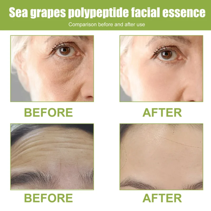 EELHOE Sea Grape Polypeptide Facial Essence Fade Fine Line Anti-wrinkle Firming Skin Lifting Moisturizing Booster Face Serum - Image 5