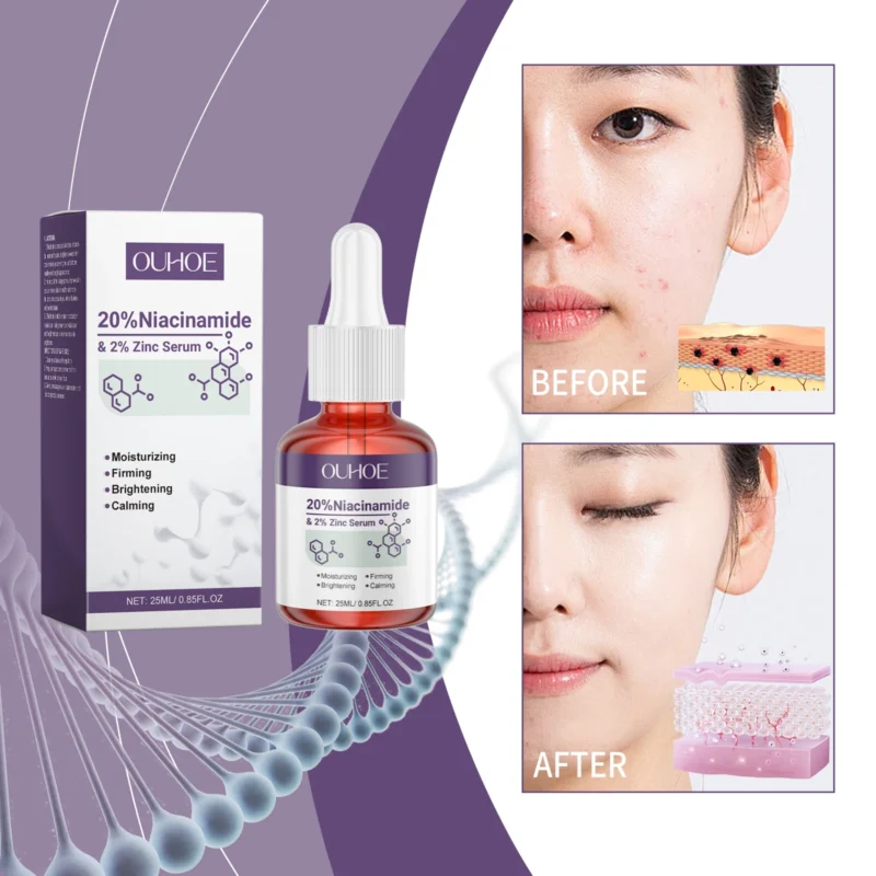 OUHOE Niacinamide Zinc Serum - Even Skin Tone, Shrink Pores, Deep Moisturize, Anti - acne, All - round Skin Glow - Image 6