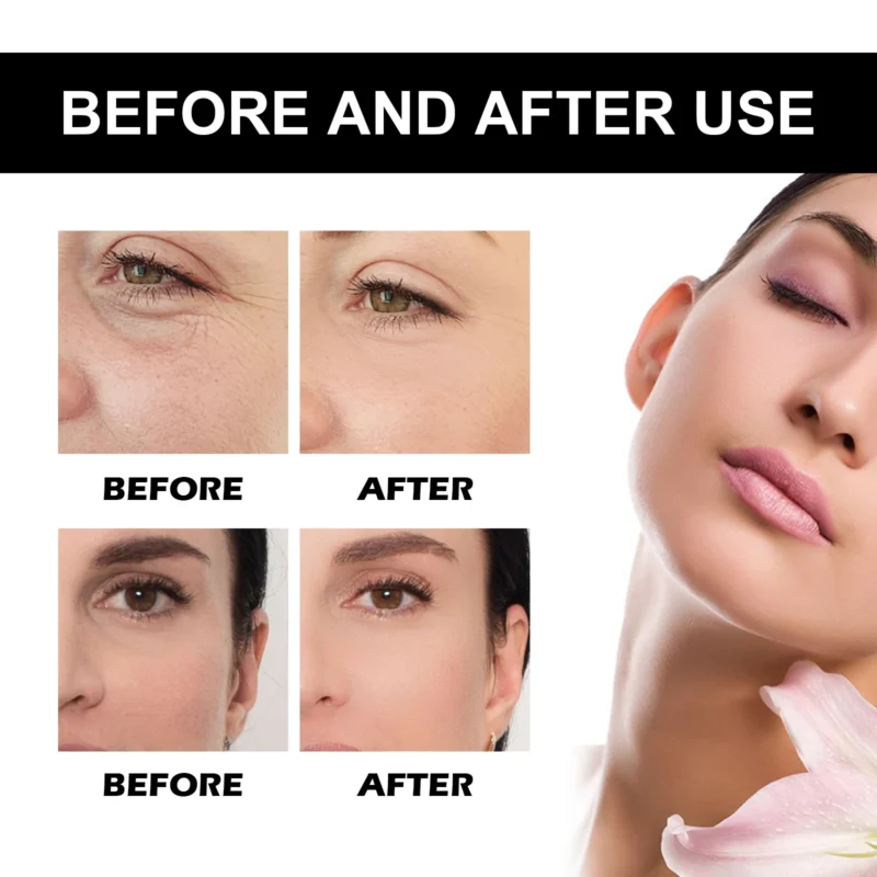 Vitamin C Serum Brightening Hydrating Facial Essence for Glowing Skin, Revitalizing Treatment, Anti-Dark Spot Whitening Care - Image 6